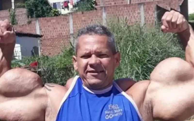 Morre Arlindo de Souza, o Popeye Brasileiro, aos 55 anos